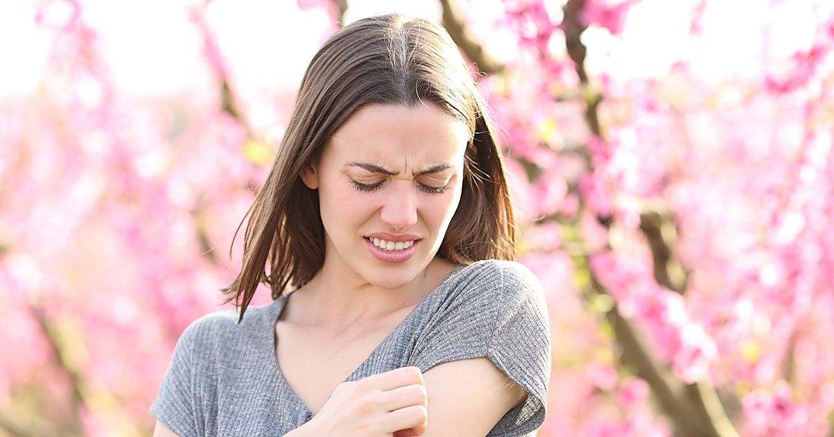 Vicent Alonso, doctor y dermatólogo: "La población suele infravalorar la fuerza del sol en primavera"